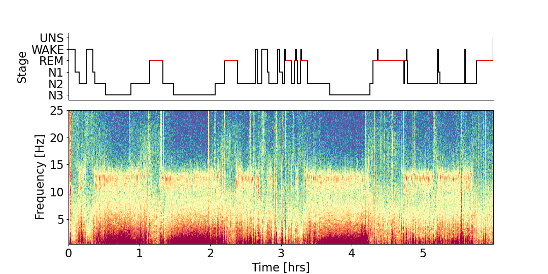 ../_images/yasa-plot_spectrogram-2.png
