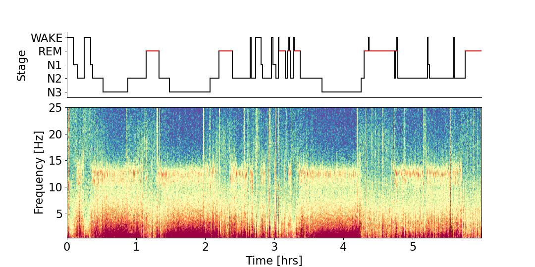 ../_images/yasa-plot_spectrogram-3.png