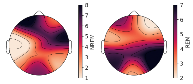 ../_images/yasa-topoplot-3.png